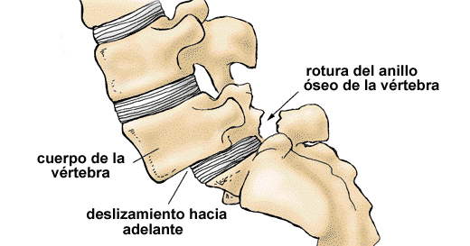 IMAGEN-3 PATOLOGÍAS ASOCIADAS AL DOLOR LUMBAR